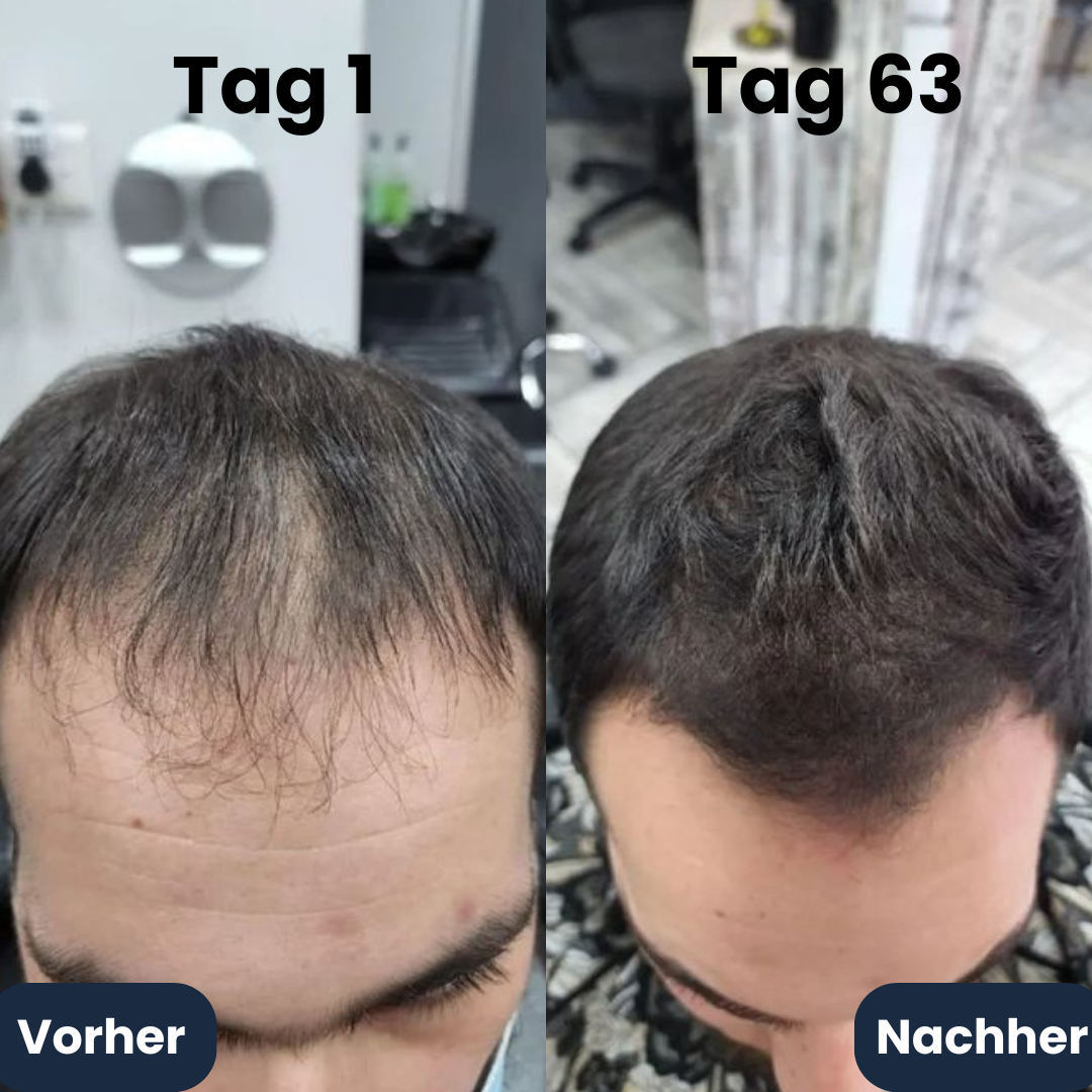 Folinor™ Kraftvolles Haarwachstums-Serum